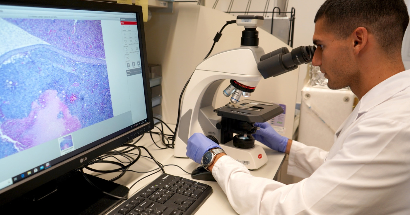 La recerca oncològica, essencial per augmentar la supervivència en càncer